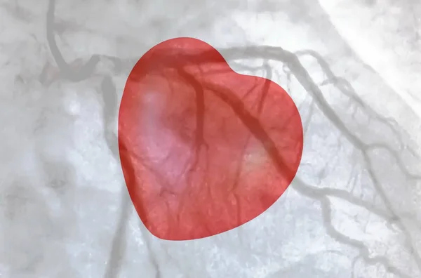 Cévkování Malé Červené Srdce Srdeční Ventrikulografie Lékařská Zobrazovací Test Slouží — Stock fotografie