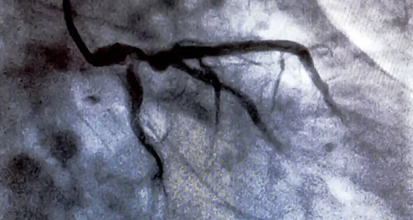 心脏脑室造影是一种医学影像学测试 用于确定患者在右心室或左心室的心功能 — 图库照片