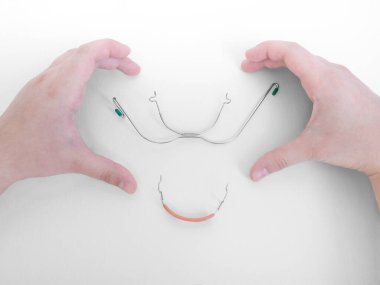 Eller ortodontik cihazın etrafında, kalp şeklinde beyaz zemin üzerinde, üst dişler için çıkarılabilir metal askılar, alt dişler için kauçuk bantlarda kullanılan plastik kapaklar. Boşluğu kopyala