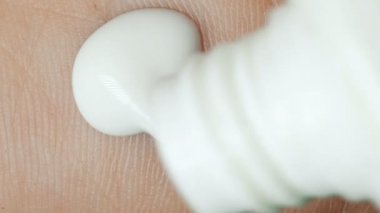 El ve merhem, makro ciltte solmuş yara