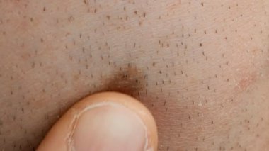 annelerin erkek yüz cilt üzerinde işaretlemek