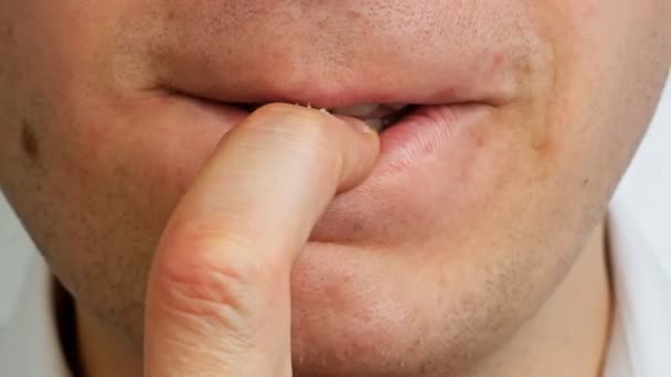 Homem estressado por dentes rói sua unha no dedo, close-up — Vídeo de Stock