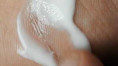 kol ve parmak bir krem sürtünme deride yara