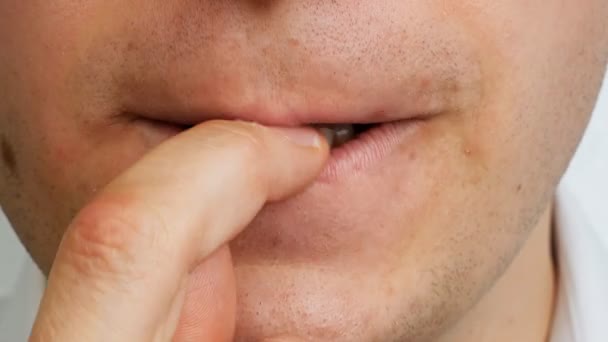 歯で男の指に自分の爪を食べる、クローズ アップ、人間の問題 — ストック動画