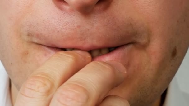 Nerveuze man door tanden crunches zijn spijker op vinger, close-up — Stockvideo