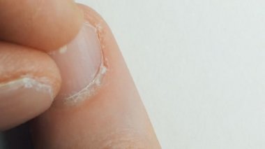 damat kötü katılımsız çivi ve manikür, tırnak