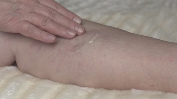Женщина мажет крем для лечения варикозного расширения вен на ноге, крупным планом, замедленным движением, мазью — стоковое видео