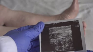 Ultrason resmini doktor bakar Ven Trombozu ve yavaş mo bir womans bacaklarda varis