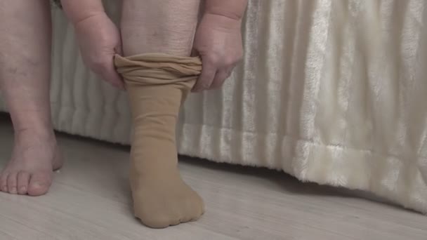 Frau trägt medizinische Strümpfe gegen Krampfadern an den Beinen, Behandlung — Stockvideo