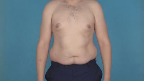 一个赤裸的胖肚子的年轻人跳起,在肚子上摇动脂肪褶皱和脂肪,营养不良和肥胖的概念,慢动作,医疗保健,啤酒肚 — 图库视频影像