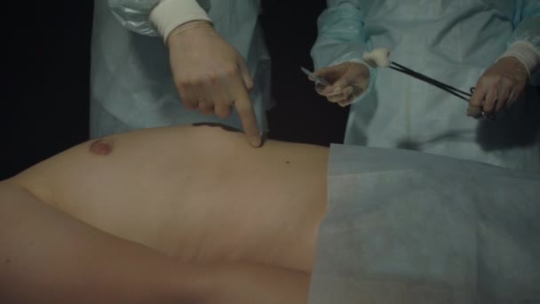 El cirujano muestra al asistente dónde hacer una incisión en el cuerpo del paciente durante la operación o el procedimiento. La persona yace en la mesa quirúrgica del hospital. Doctor con bisturí y forcep listo para empezar a cortar — Vídeos de Stock