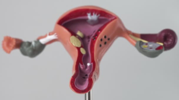 Imbroglione sistema riproduttivo femminile su uno sfondo bianco. Il concetto di malattie femminili in ginecologia, processo infiammatorio e cancro, spazio di copia — Video Stock