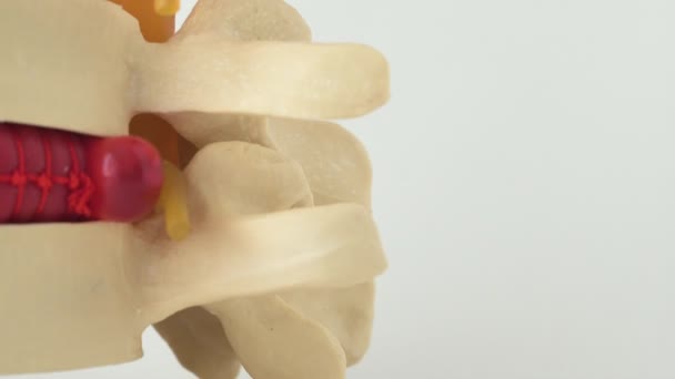 El médico neurólogo sostiene una columna simulada con hernia intervertebral. Concepto de enfermedad de la columna vertebral y hernia secuestrada o mediana, segmento espinal, osteocondrosis, espacio de copia — Vídeo de stock