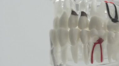 Kötü dişli beyaz bir arka planda insan çenesinin yapısı. Tedavi ve hastalıklı dişlerin doldurulması, lazer tedavi yöntemi, makro