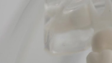 Çeneye vida takılmış diş implantları. Modern dişçilik prosedürü kavramı, diş implantları, arka plan