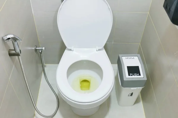 Vies Toilet Met Urine Tekenen Van Uitdroging Van Het Lichaam — Stockfoto