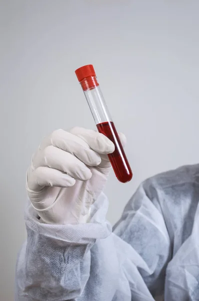 Судмедэксперт держит в руках бутылку с образцом крови — стоковое фото