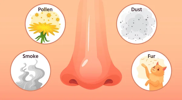 Maladie allergique. Nez rouge, symptômes de maladies allergiques et allergènes. Illustration vectorielle de dessin animé sur la fumée, le pollen et les allergies aux poussières — Image vectorielle