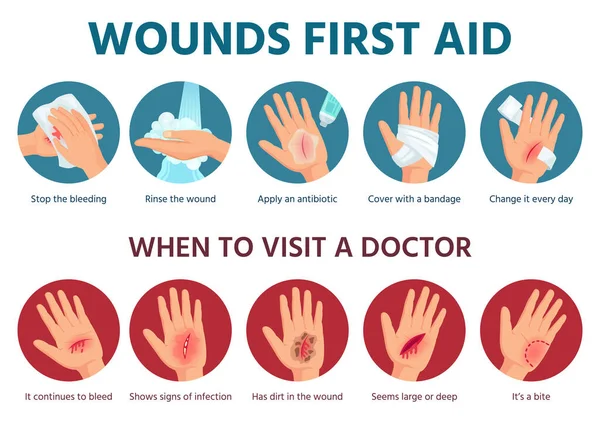 Eerste hulp voor wond op de huid. Behandelingprocedure voor bloedingen. Bandage op gewonde palm. Noodsituatie veiligheid infographic in vector — Stockvector