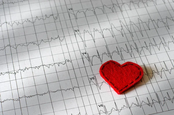 Elektrokardiyogram kağıt üzerinde. Kırmızı kalp kumaştan yapılmış. Düz üstten görünüm