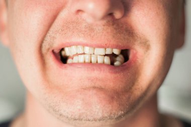 Erkeğin Ağzı Gülümsüyor. Gülümseyen Kızıl Saçlı Genç Dudaklar