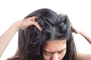 women head with dandruff Caused by the problem of dirty. Or caused by skin disease or Seborrheic Dermatitis. It has white scaly and it will cause itch. clipart