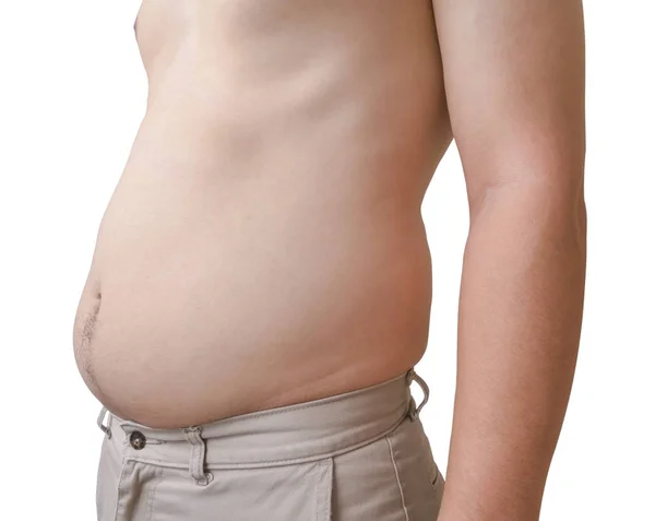 Young Man Shows Fat Belly White Background — Stock Photo, Image