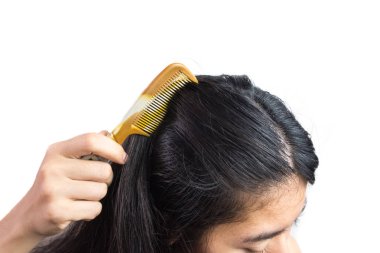 Kirli sorunlardan kaynaklanan kepekli kadın kafası. Ya da deri hastalığından ya da deri iltihabından. Beyaz pullu ve kaşıntıya neden olacak. beyaz arkaplan ve kırpma yolu üzerinde izole.