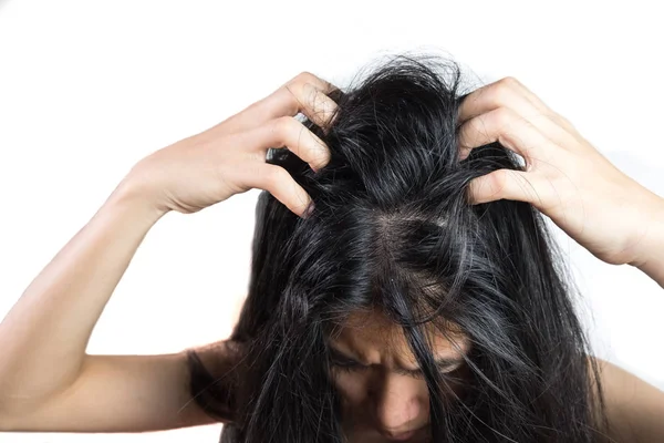 Women Head Dandruff Caused Problem Dirty Caused Skin Disease Seborrheic — Stock Photo, Image