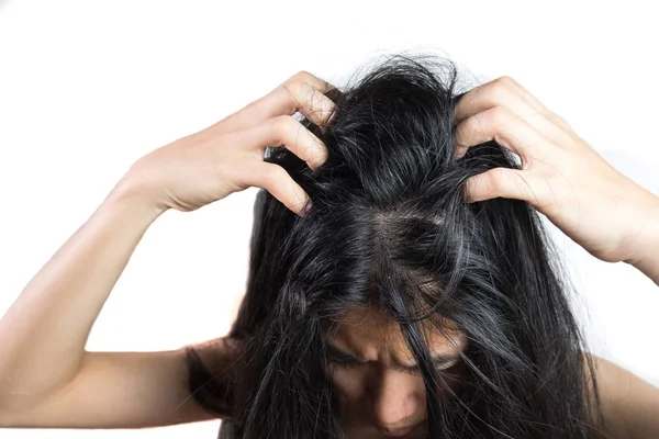 Mujeres Cabeza Con Caspa Causada Por Problema Suciedad Causada Por Imagen de stock