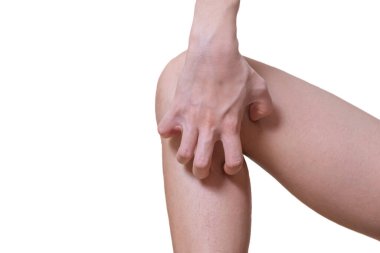 Genç kadınların bacaklarında alerji belirtileri oluşur. Ellerini isilik için kullanır. beyaz arkaplan ve kırpma yolu.