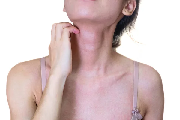 Girl Who Caused Itching Body Allergies Skin Disease Caused Fungus — Stock Photo, Image