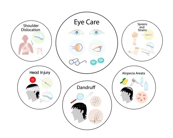 Медицинская Концепция Иллюстрация Растяжений Штаммов Периодическое Вывих Плеча Травма Головы — стоковый вектор
