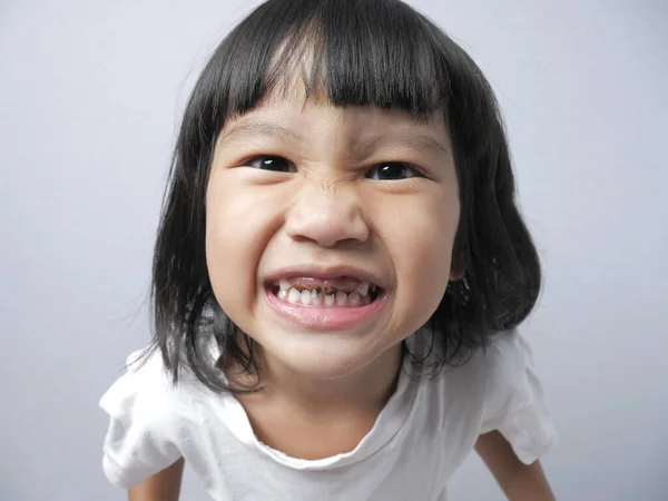 Bambina sorridente mostra che carie dente — Foto Stock