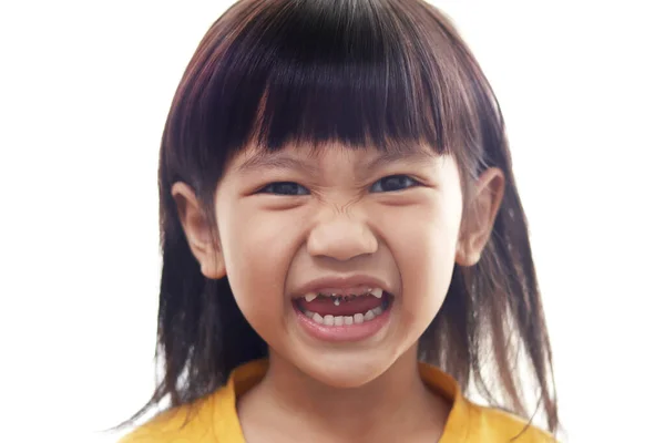 Asiatica Bambina Mostrando Bocca Aperta Piena Carie Carie Carie Denti — Foto Stock
