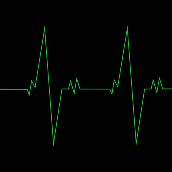 Sistema Monitorización Cardiovascular Aislado Sobre Fondo Negro Pulso Cardíaco Señal — Vector de stock