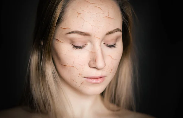 Woman Cracked Skin Cosmetic Dehydration Effect Concept — Stock Photo, Image