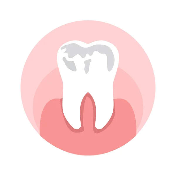 Cáries, Buracos em dente plana Vector Ilustração —  Vetores de Stock