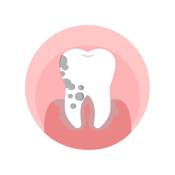 Odontolith, Dental Disease Vector Illustration — Stock Vector