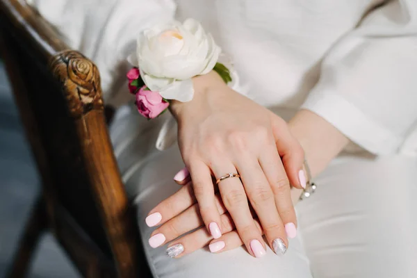 Ein Junges Mädchen Weiß Verschränkte Ihre Arme Mit Einem Ehering — Stockfoto