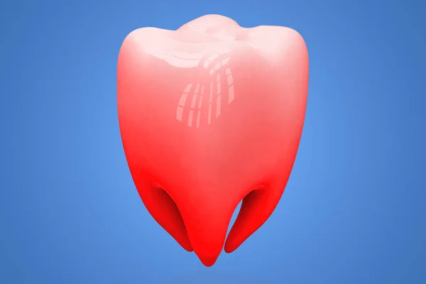 Koncepcja ból zębów, próchnica koncepcja na białym tle na niebieskim tle. renderowania 3D — Zdjęcie stockowe