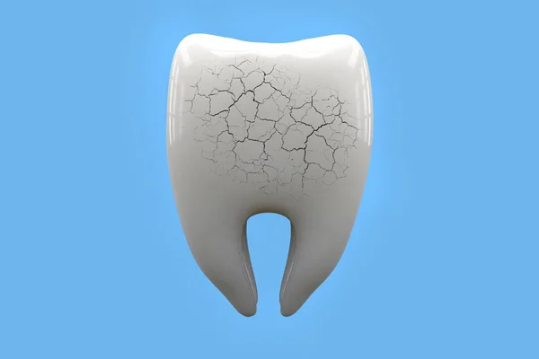 歯痛、歯科医療コンセプト。青の背景 3 d レンダリングに不健康なひびの入ったし、壊れた歯 — ストック写真