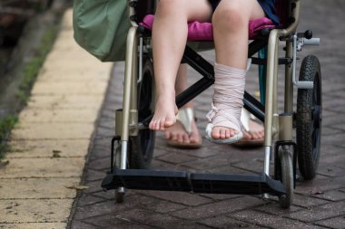 Hasta çocuk tekerlekli sandalye üzerinde oturan bir yürüyüş ve dinlenme parkı vermek. Kırık bacak kazara alçı ve oklüzal splint ile sarılmış. Sağlık ve sigorta için çocuk kavramı.