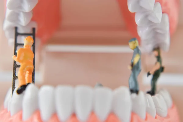 Close Pessoas Miniatura Trabalhador Limpeza Modelo Dente Como Médico Cuidados — Fotografia de Stock