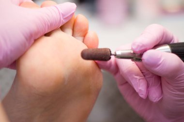 Profesyonel donanım pedikür pembe eldiven ve elektrikli cihaz makine kullanarak. Hastaya tıbbi pedikür yordamı, ayak hastalıkları uzmanı ziyaret etti. Peeling Ayak. Ayak tedavi Spa salonda. Podiatry Kliniği