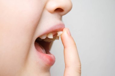 Gülümseyen ve parmağını ile açık ağız içinde titrek süt diş sallayarak bebek kız. İlk azı dişleri. Sağlık, diş hijyeni ve çocukluk kavramı.