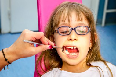 Gözlüklü tatlı küçük kız portresi, diş hekimi kapalı çocuk
