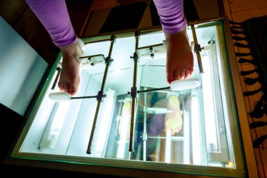 Ortopedi uzmanı ile çocuğun ayak ölçme 