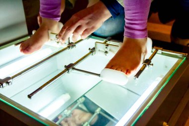 Ortopedi uzmanı ile çocuğun ayak ölçme 