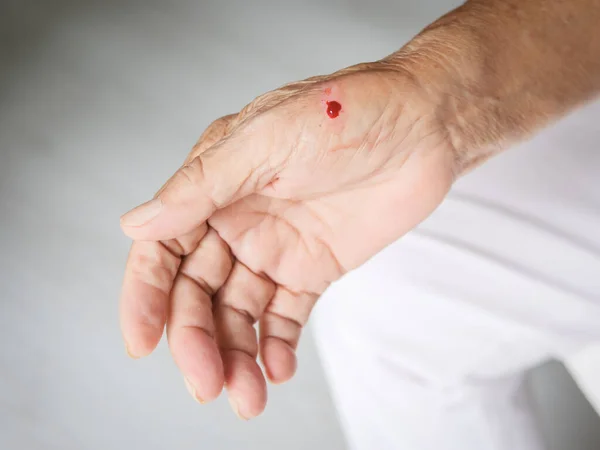 Mano anziana con sangue, incidente a casa . — Foto Stock